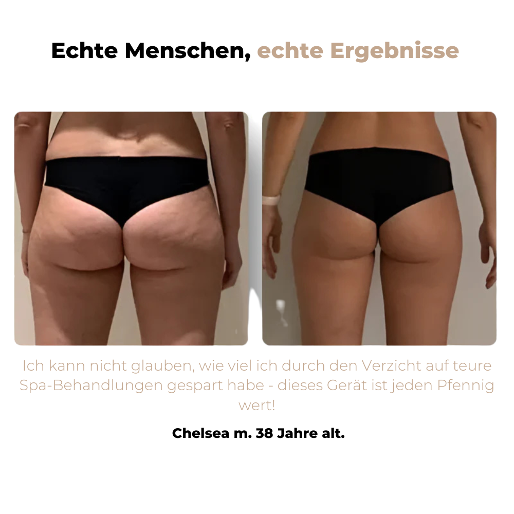 Elena™ | Anti-Cellulite Massagegerät für straffe Haut