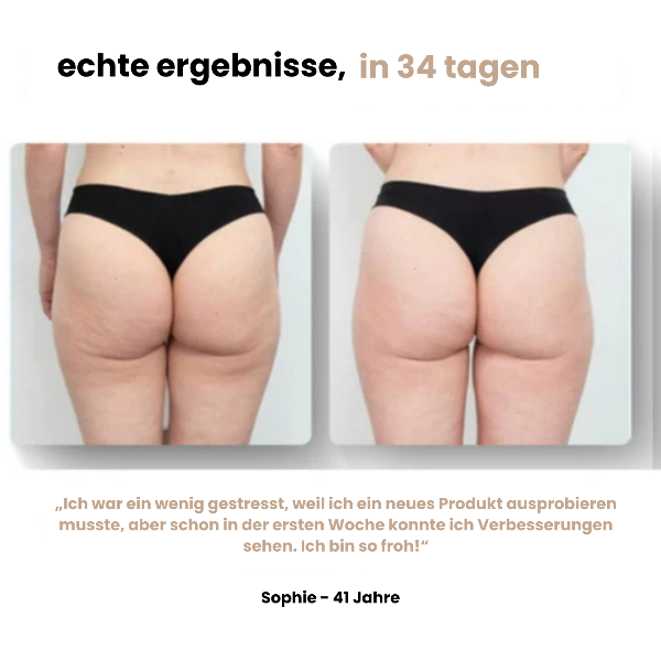 Elena™ | Anti-Cellulite Massagegerät für straffe Haut